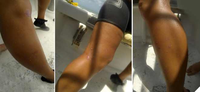 Health Issues for Dive Instructors